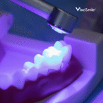 فیشور سیلانت proseal f برند vincismile - Image 2