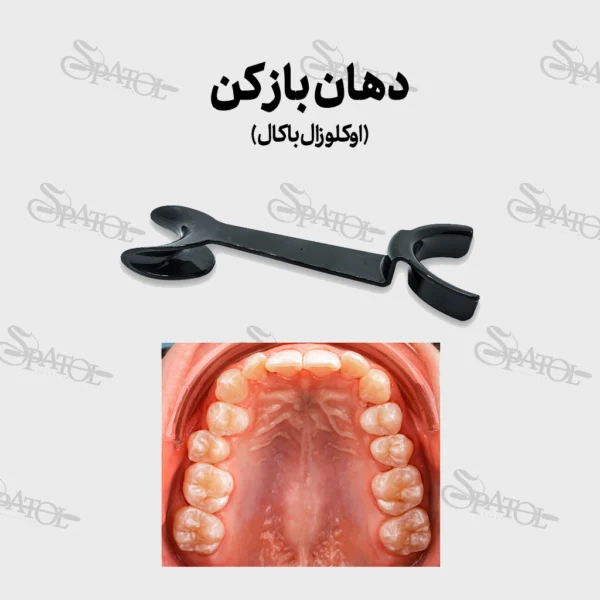دهان بازکن اوکلوزال باکال دوسر 152B پارس اکسیر - Image 2