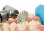 دیسک خورشیدی کامپوزیت Jiffy Natural composite system spiral wheel Medium  برند الترادنت Ultradent - Image 3